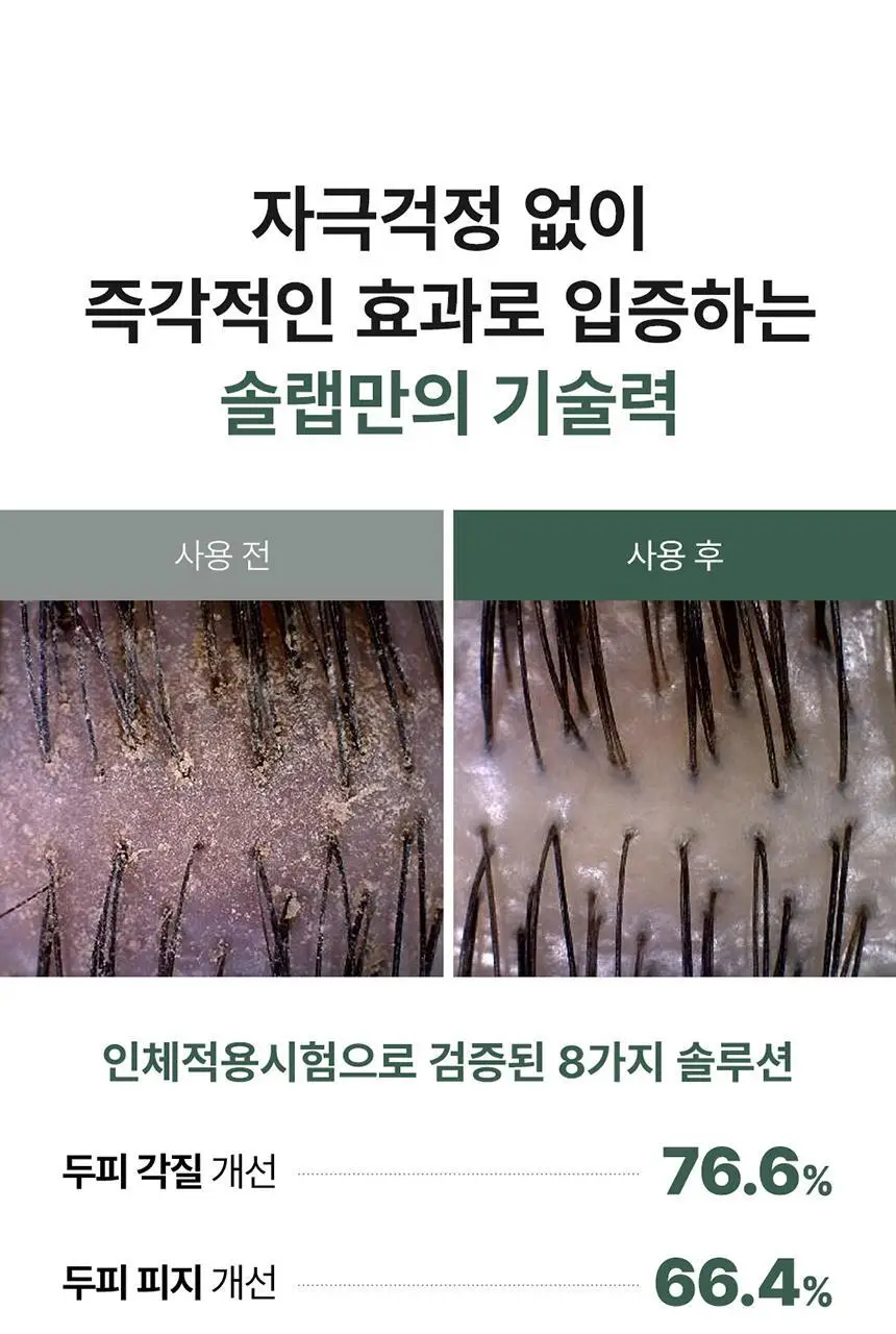 [두피 스케일링]피지/각질/냄새 전문가케어 솔랩 아쿠아픽 두피스케일러 250ml + 브러쉬 기획 상세페이지 17